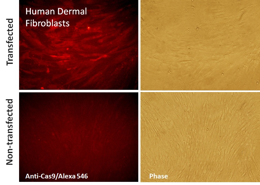 Cas9 mRNA transfection with EditPro reagent human fibroblasts