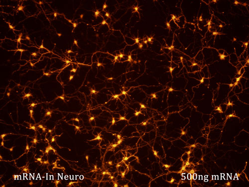 500 ng transfection of neurons