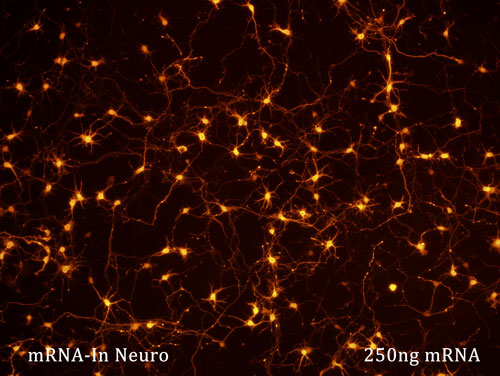 250 ng transfection of neurons