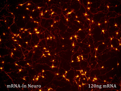 120 ng transfection of neurons